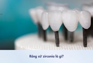 Răng sứ Zirconia là gì? Vì sao được ưa chuộng hiện nay?