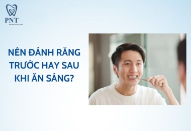 Nên đánh răng trước hay sau khi ăn sáng thì tốt? Bác sĩ nha khoa giải đáp chi tiết