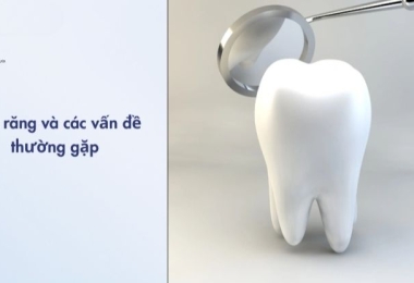 Men răng là gì? Cấu tạo, vai trò và các vấn đề thường gặp bạn cần biết