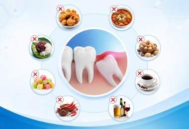 Nhổ răng khôn kiêng ăn gì? Những loại thức ăn phải tránh xa