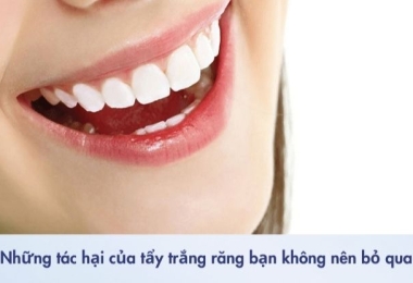 🦷 Những tác hại của tẩy trắng răng bạn không nên bỏ qua