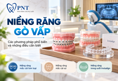 Niềng Răng Gò Vấp: Các Phương Pháp Phổ Biến Và Những Điều Cần Biết