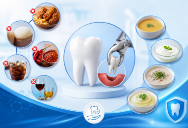 Nhổ răng kiêng ăn gì? Những lưu ý quan trọng trước và sau khi nhổ răng