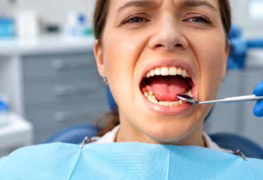 Răng Khôn Mọc Lệch Có Những Dấu Hiệu Nào Cần Chú Ý?