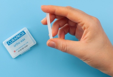 Sáp nha khoa là gì? "Cứu tinh" không thể thiếu cho người niềng răng