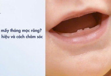 Trẻ mấy tháng mọc răng? Các giai đoạn, dấu hiệu và cách chăm sóc