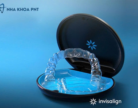 Khay Invisalign bổ sung
